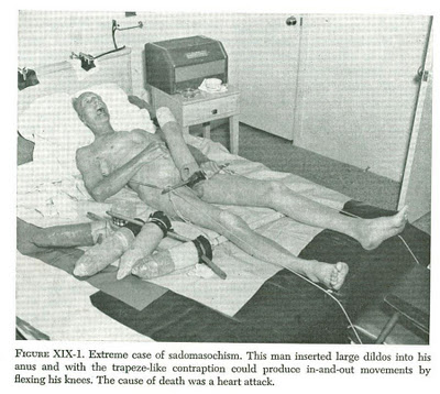 φρίκη κάψιμο δονητές sadomazo bdsm orgy