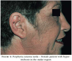 en_a10fig4